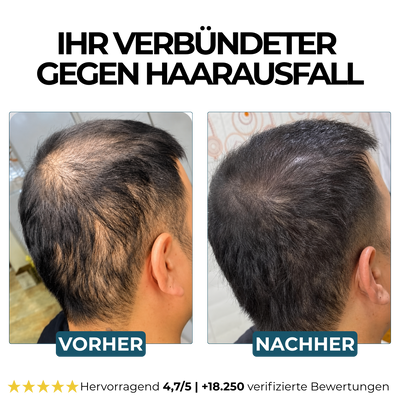 Morge Skin™ Haarwurzel-Aktivator Shampoo
