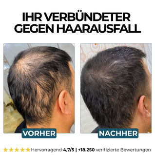 Morge Skin™ Haarwurzel-Aktivator Shampoo