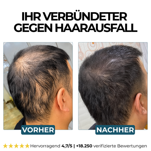 Morge Skin™ Haarwurzel-Aktivator Shampoo