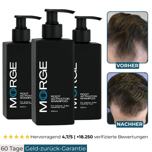 Morge Skin™ Haarwurzel-Aktivator Shampoo