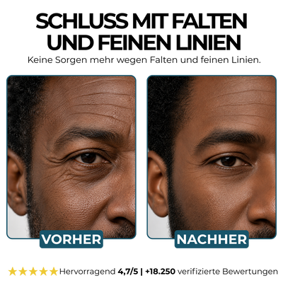 Morge Faltenabwehr-Talgbalsam - Black Edition