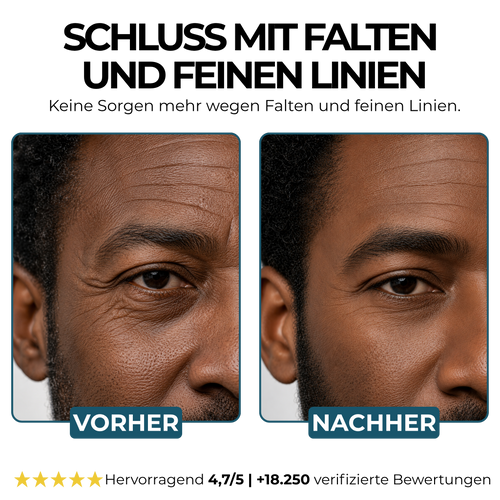 Morge Faltenabwehr-Talgbalsam - Black Edition