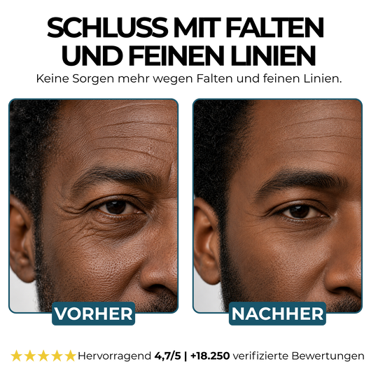 Morge Faltenabwehr-Talgbalsam - Black Edition